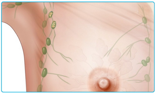 Image of a breast showing lymph nodes